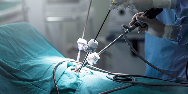 Laparoscopic Surgery in Patna  Fertility Care